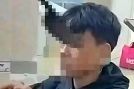 Thiếu niên 15 tuổi bị dao cắm vào hốc mắt vì chơi dao