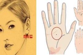 Những nốt ruồi mang phúc khí, tài lộc kéo đến không ngừng