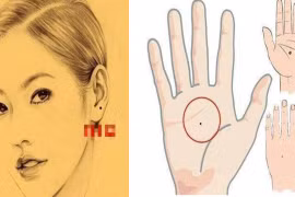 Những nốt ruồi mang phúc khí, tài lộc kéo đến không ngừng