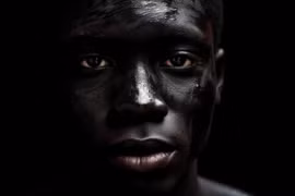 Tại sao đàn ông da đen mắc ung thư tuyến tiền liệt cao hơn?