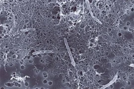 Sinh vật kỳ lạ nhất Trái đất, sống sót nhờ năng lượng phóng xạ