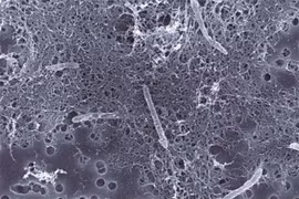 Sinh vật kỳ lạ nhất Trái đất, sống sót nhờ năng lượng phóng xạ