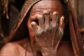 Rợn người tục cắt tay khi người nhà mất ở bộ tộc Dani