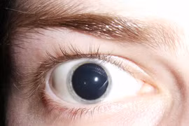 Loại ma túy "cực độc" gây tâm thần phân liệt suốt đời