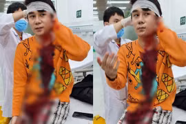 Chi tiết vụ diễn viên phim "Thương ngày nắng về" bị chém