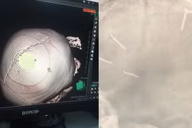 Gia cảnh đáng thương của bé 3 tuổi nghi bị bạo hành ở Hà Nội