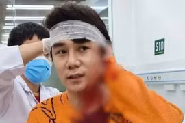 Nam diễn viên bị chém ở Hà Nội: Thương tật dưới 11% xử lý thế nào?