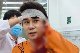 Nam diễn viên bị chém ở Hà Nội: Thương tật dưới 11% xử lý thế nào?
