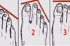 Người giàu có thường sở hữu 4 tướng bàn chân này