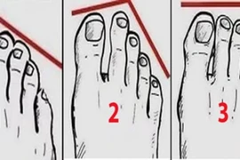 Người giàu có thường sở hữu 4 tướng bàn chân này