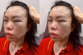 Hà Nội: Nghi vấn người phụ nữ bị chồng cũ bắt giữ, đánh đập