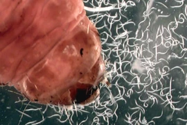 Nổi da ga những sinh vật kinh dị nhất dưới ống kính hiển vi