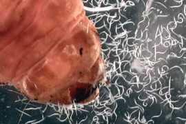 Nổi da ga những sinh vật kinh dị nhất dưới ống kính hiển vi