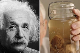 Bác sĩ “điên rồ” nào cả gan đánh cắp bộ não của thiên tài Einstein? 