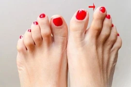 Sở hữu điểm này trên bàn chân, sinh ra đã có số giàu sang