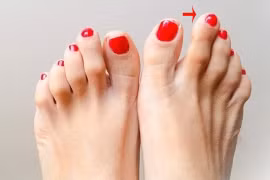 Sở hữu điểm này trên bàn chân, sinh ra đã có số giàu sang