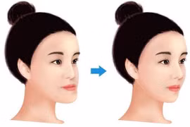 Bật mí số vận tướng người mặt gãy: Có chán như lời đồn?