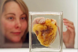 Người phụ nữ thấy trái tim mình trưng bày tại bảo tàng sau 16 năm