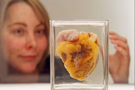 Người phụ nữ thấy trái tim mình trưng bày tại bảo tàng sau 16 năm