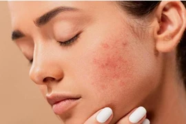 Các yếu tố âm thầm gây ung thư da