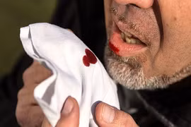 Chế độ ăn uống cho người bị xuất huyết dạ dày