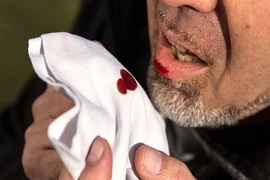 Chế độ ăn uống cho người bị xuất huyết dạ dày