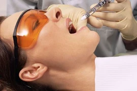 Làm gì sau khi nhổ răng khôn để mau lành và không đau nhức?