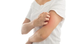 Làm thế nào để giảm ngứa khi bị dị ứng với nấm mốc?