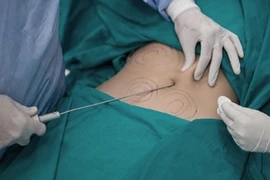 Thanh tra Sở Y tế TP HCM thông tin về trường hợp cấp cứu sau khi hút mỡ