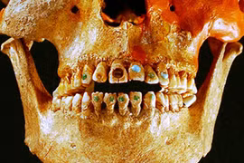 Top sự thật không tưởng về hàm răng