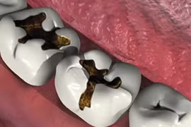 Top các bệnh răng miệng nguy hiểm dễ tấn công người già