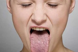 Phương pháp chữa khó nuốt dễ dàng sau điều trị ung thư