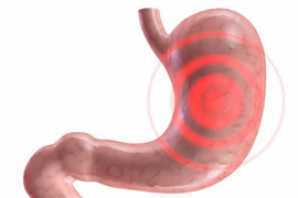 13 dấu hiệu bạn bị viêm dạ dày 