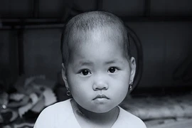 Chọn đồ cho bé điều trị ung thư