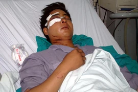 Dân “tố” 141 đánh: Tạm đình chỉ tổ Y5/141 để điều tra