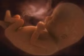 Nước ối chữa viêm ruột hoại tử cho trẻ sơ sinh