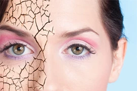 Cứu nguy làn da khô như vảy rắn