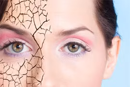 Cứu nguy làn da khô như vảy rắn