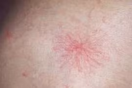 Những biểu hiện trên cơ thể báo hiệu bệnh tật