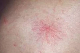 Những biểu hiện trên cơ thể báo hiệu bệnh tật