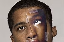 Trều môi, lác mắt vì ... ham hố làm đẹp