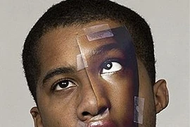 Trều môi, lác mắt vì ... ham hố làm đẹp