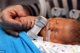 Thương tâm bé sơ sinh mang “đống bệnh” trong người