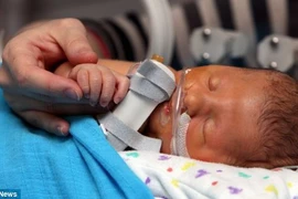 Thương tâm bé sơ sinh mang “đống bệnh” trong người