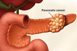 Những bộ phận “yếu đuối” nhất của nam giới