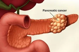 Những bộ phận “yếu đuối” nhất của nam giới