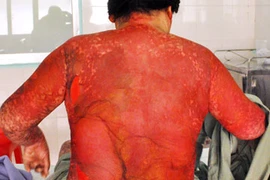 Tự ý dùng thực phẩm chức năng có thể thiệt mạng