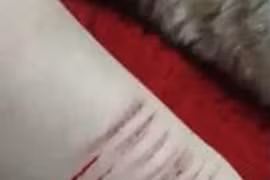 Kinh hãi clip thiếu nữ dùng dao lam tự rạch tay