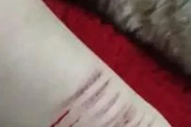 Kinh hãi clip thiếu nữ dùng dao lam tự rạch tay