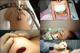 Đau đớn tột cùng khi phẫu thuật thẩm mỹ